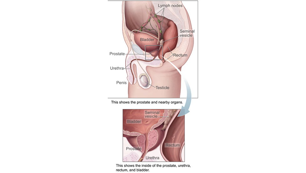 prostate diagram