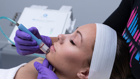 Close-up of a female client receiving a microdermabrasion treatment near her chin