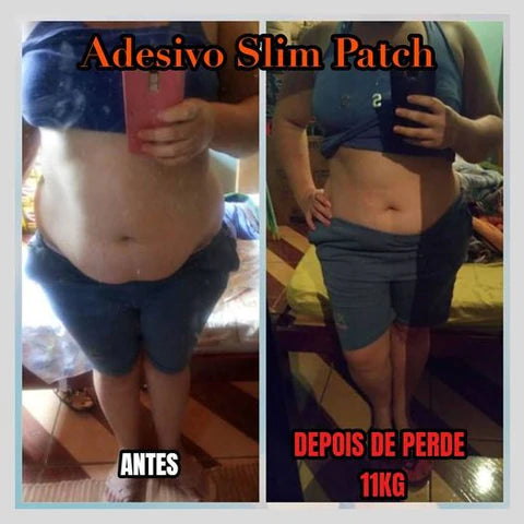 ADESIVO DETOX - SLIM PATCH - 100% NATURAL – Raposaonline.