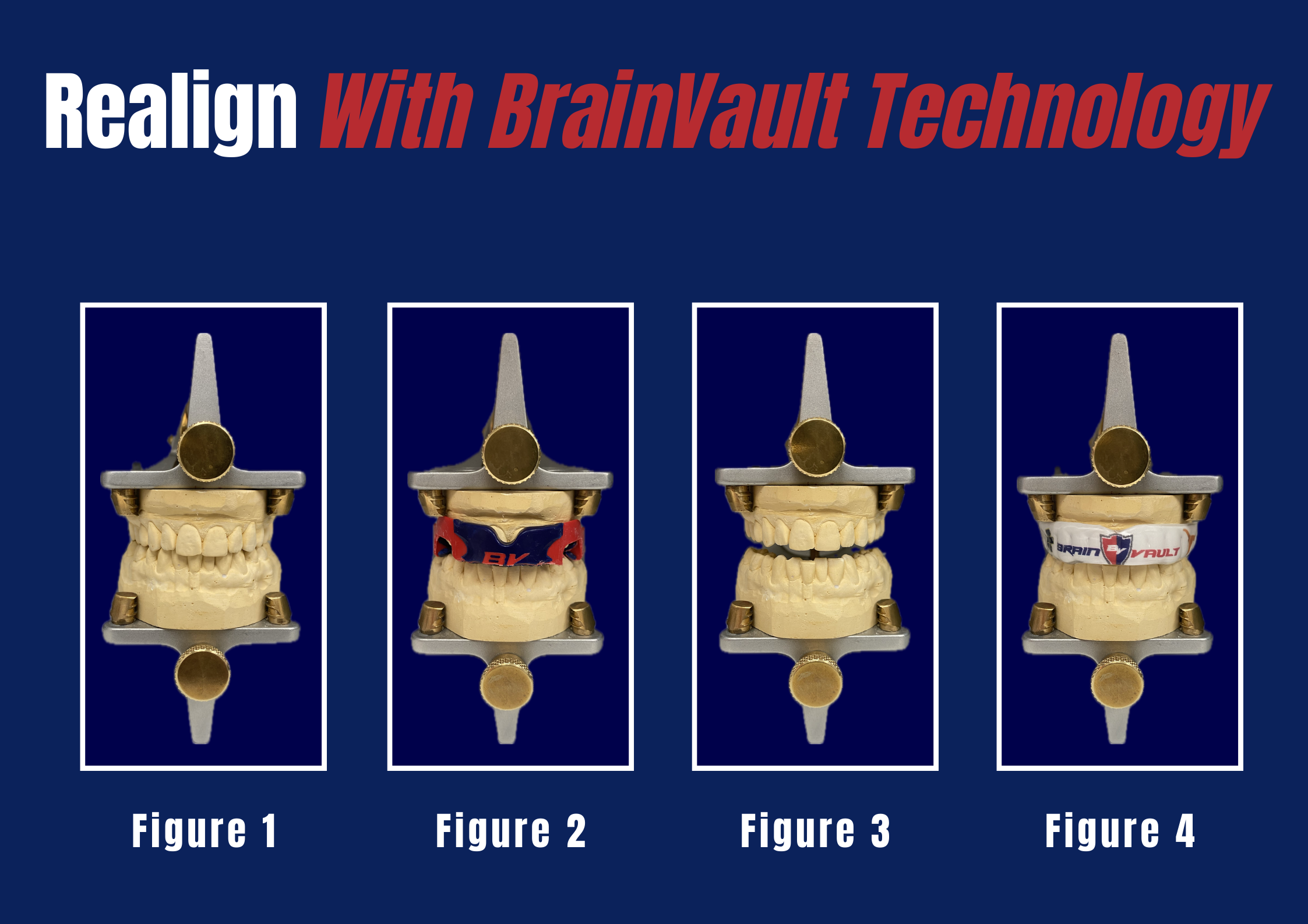 Realign with BrainVault Technology