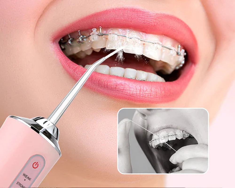 the Water Jet Flosser is Ideal for Braces
