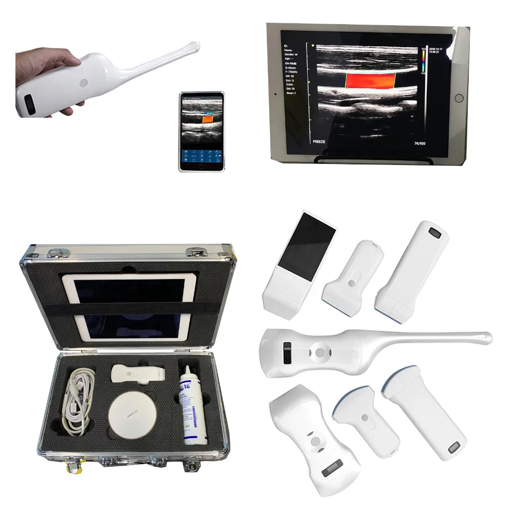 3-in-1 Handheld Portable Ultrasound Scanner | Color Doppler Wireless for Android & iOS