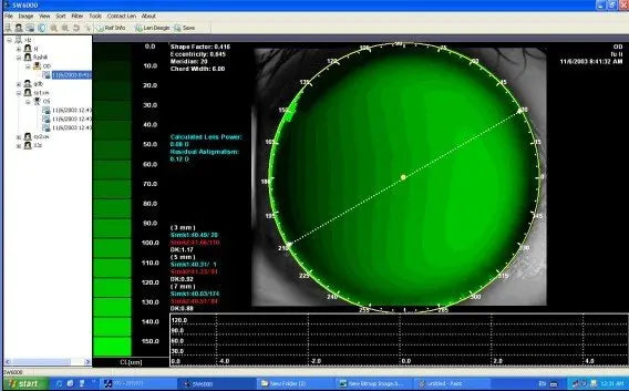 SW-6000 Ophthalmic equipment  Corneal Topography