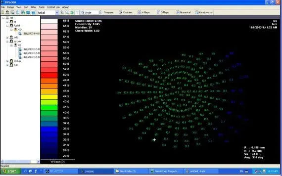 SW-6000 Ophthalmic equipment  Corneal Topography