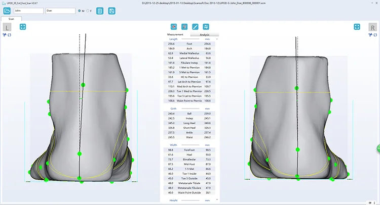 Orthopedic instrument handmade orthotic insoles UPOD 3d foot scanner for human body