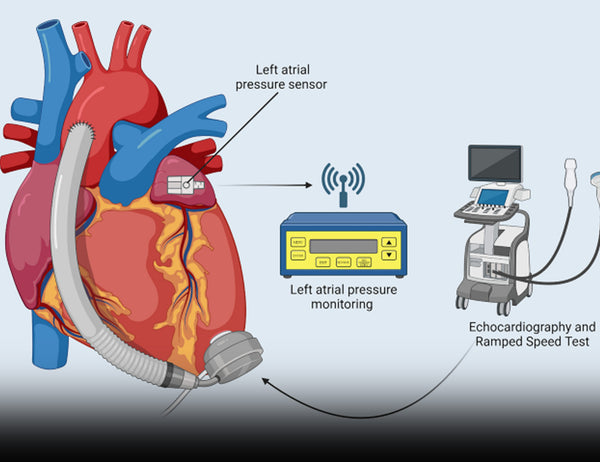 How poor habits can lead to Heart Failure and the need for LVAD support
