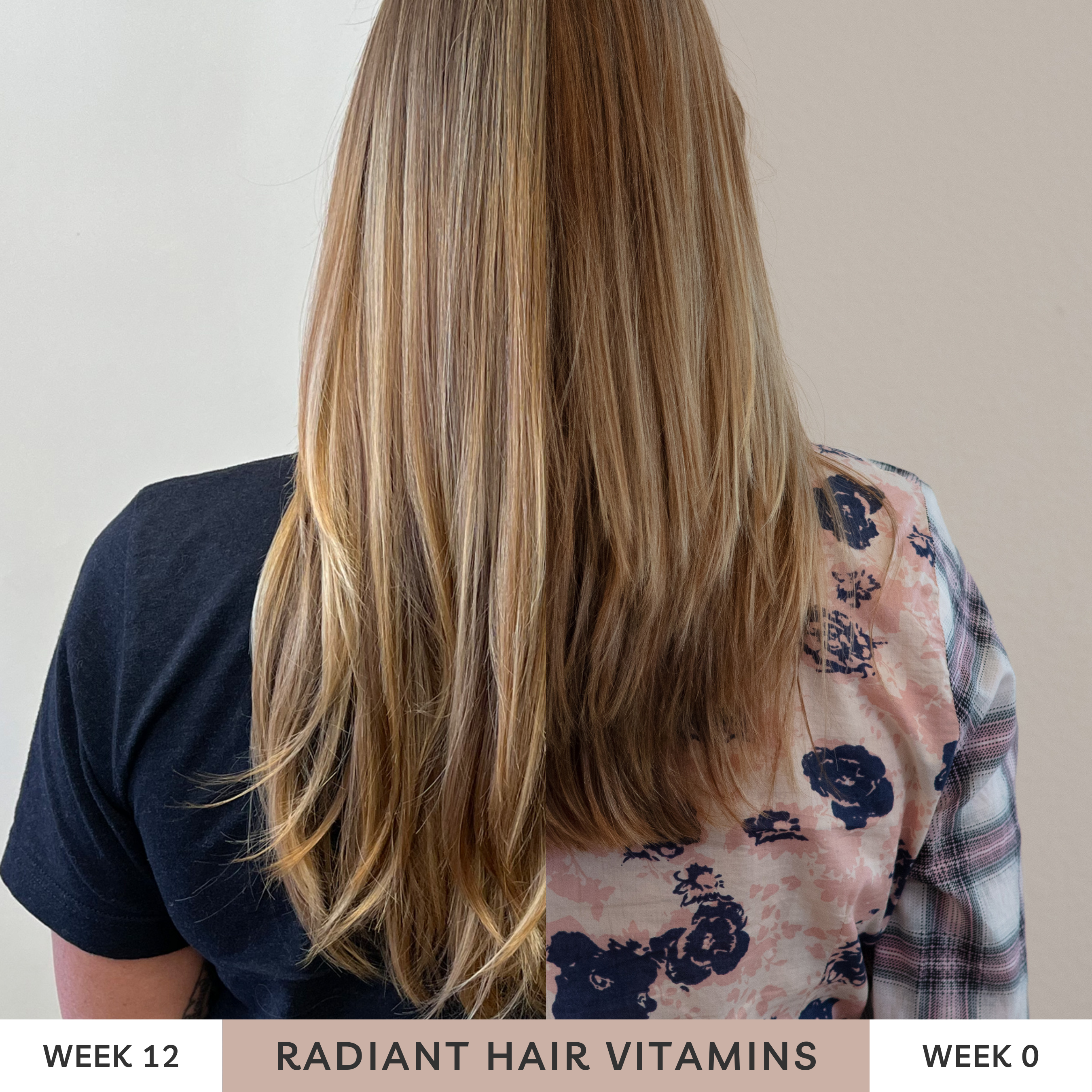 Real results for radiant hair vitamins