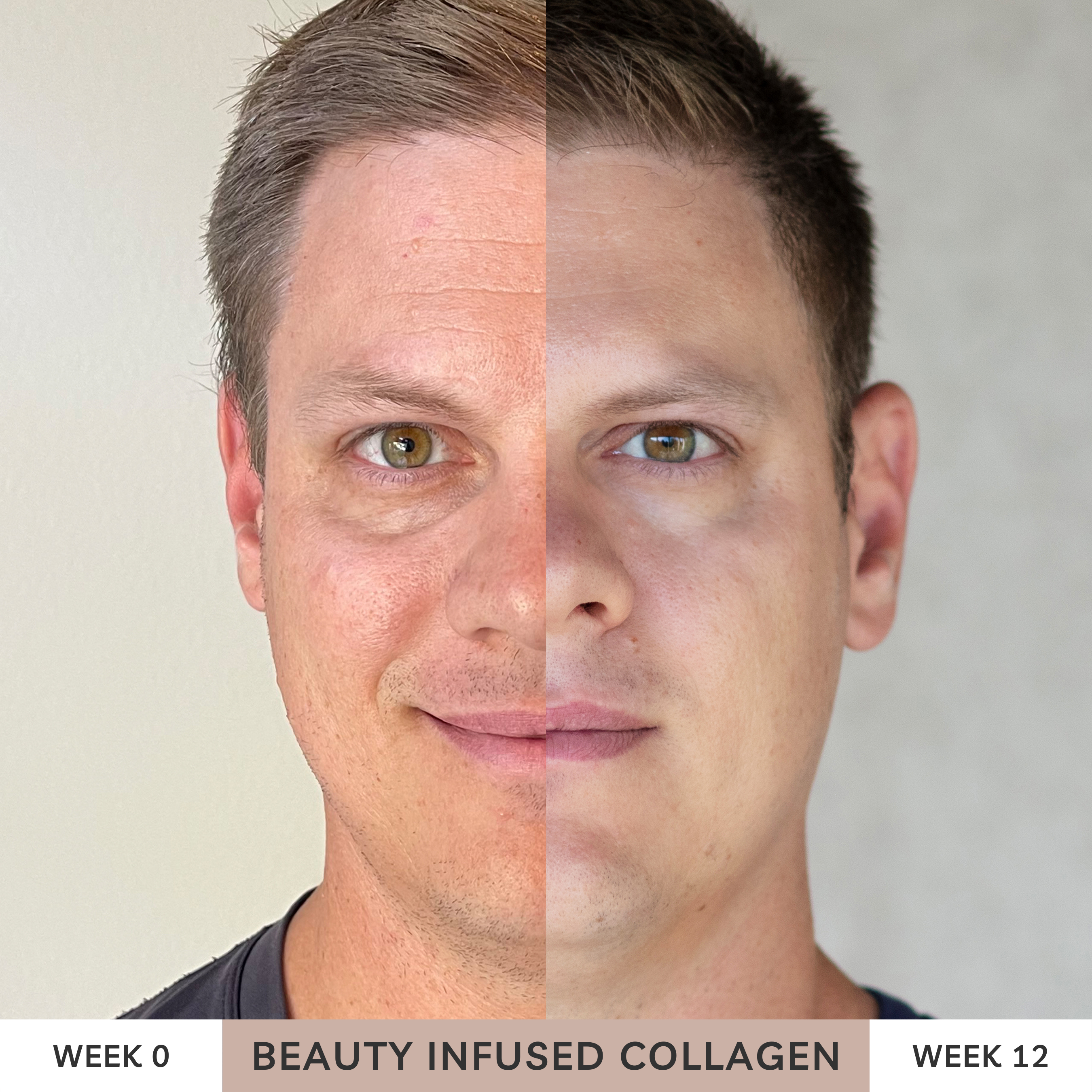 Real results for beauty infused collagen