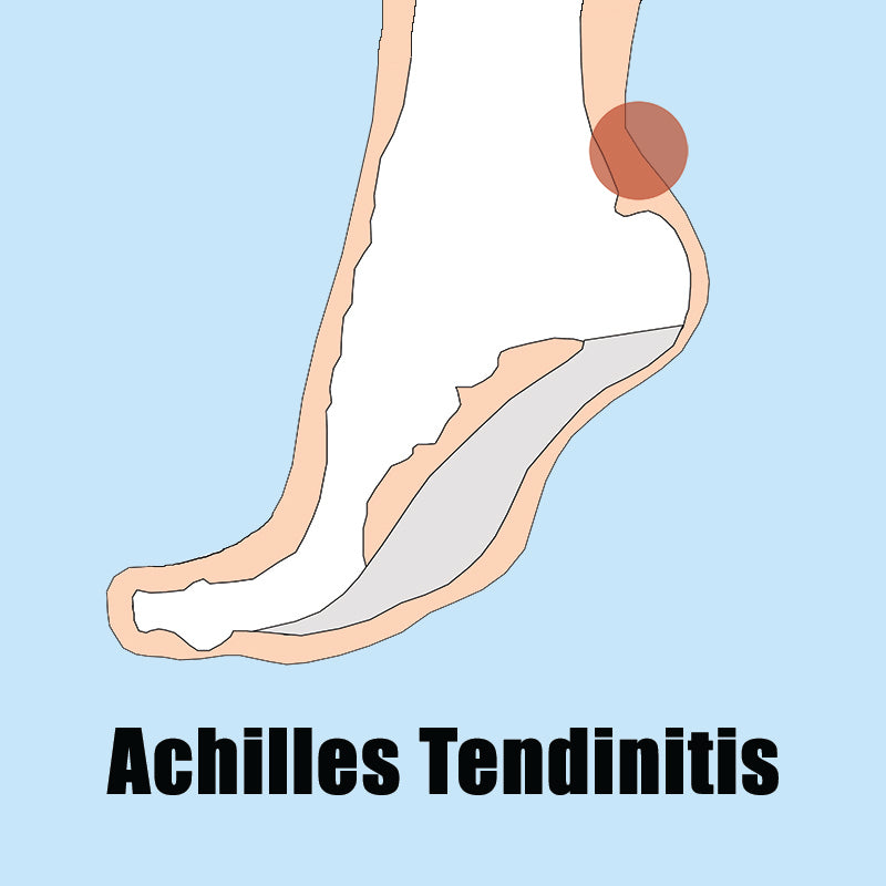 Achilles Tendinitish Pain Point Image