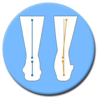 Insoles for Overpronation