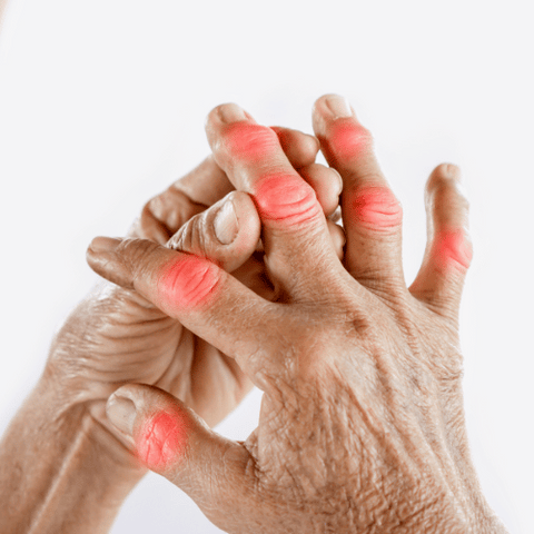 Joint Pain in Fingers