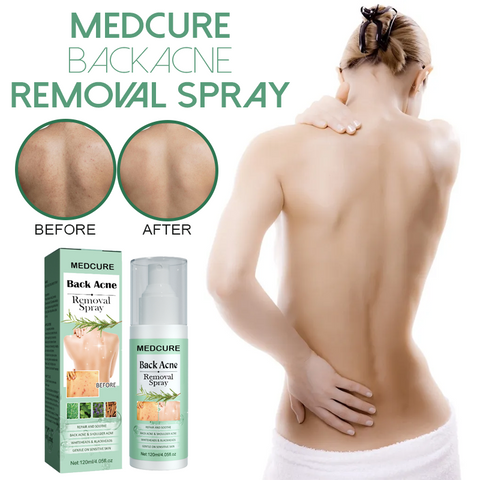 MEDCure BackAcne Removal Spray 