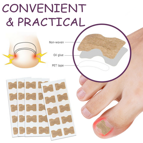 Ingrown toenails - treatment, symptoms, causes and prevention