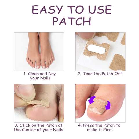 NailHeal AntiParonychia Relief Patch