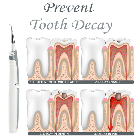 TeethWhitener Ultrasonic Vibration Cleaner
