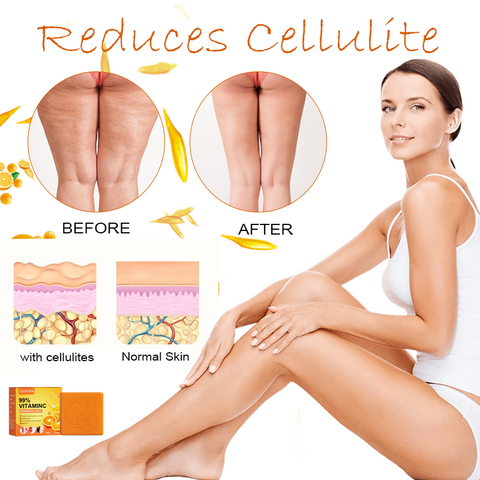 VitaminC CelluBurn Tightening Soap 