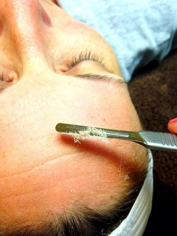 Dermaplane-with-Lactic-Peel