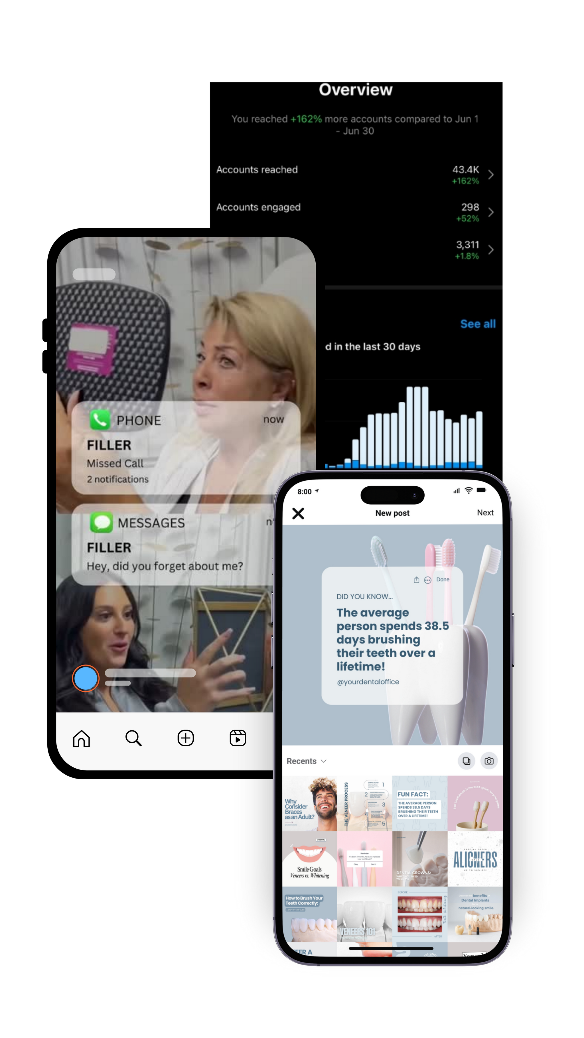 Example of Instagram content strategy results by Media by Liz, featuring custom dental marketing posts, engaging Reels, and analytics showing a 162% increase in account reach. Example of Instagram content strategy results by Media by Liz, featuring custom dental marketing posts, engaging Reels, and analytics showing a 162% increase in account reach.