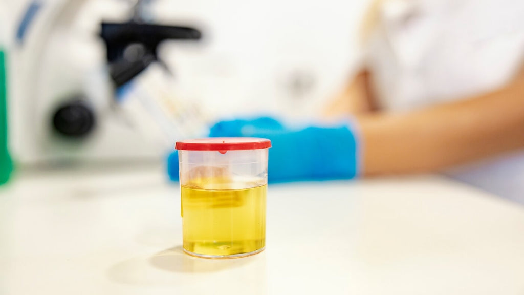 A Bottle With a Urine Sample in the Laboratory on a Desk and Laboratory Worker in the Background