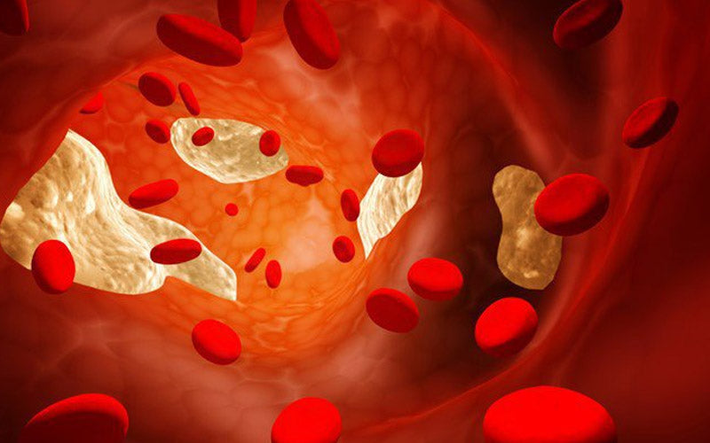 Giam-luong-cholesterol