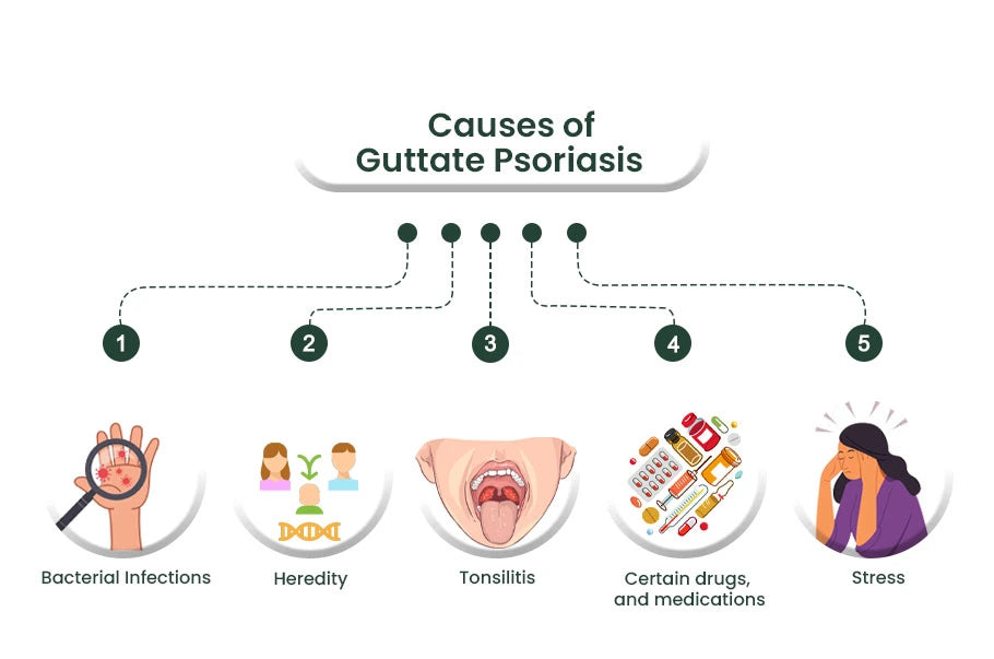 causes of guttate-psoriasis