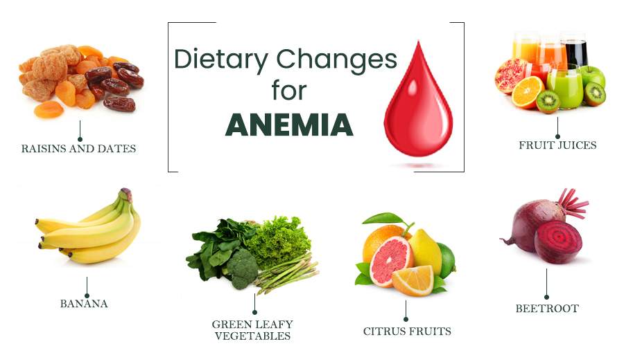 Dietary Changes for Anemia