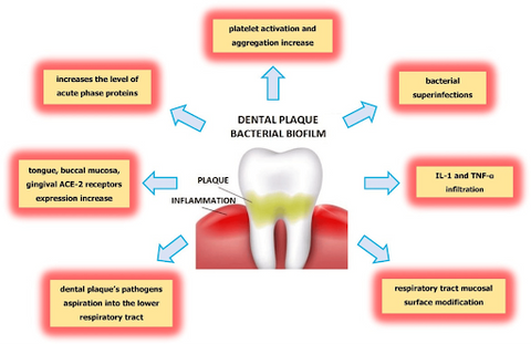 diagram that explains the process of plaque formation on human teeth