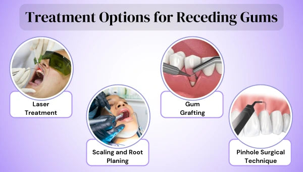 Infographic explaining different treatment options for receding gums showing laser treatment, gum grafting, pinhole surgery and scaling & root planing