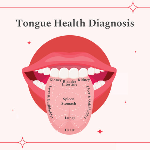 Diagnosis of a Tongue