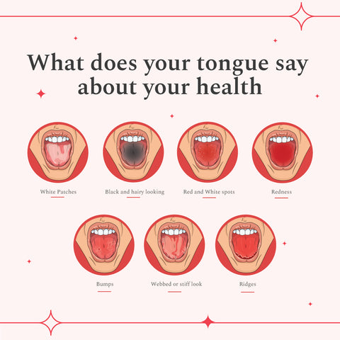 What does your tongue say about overall health? | Perfora – Perfora ...