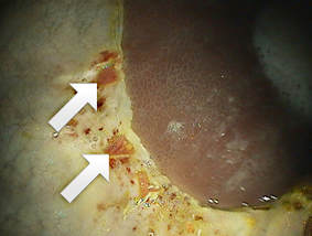 Equine gastric ulcers