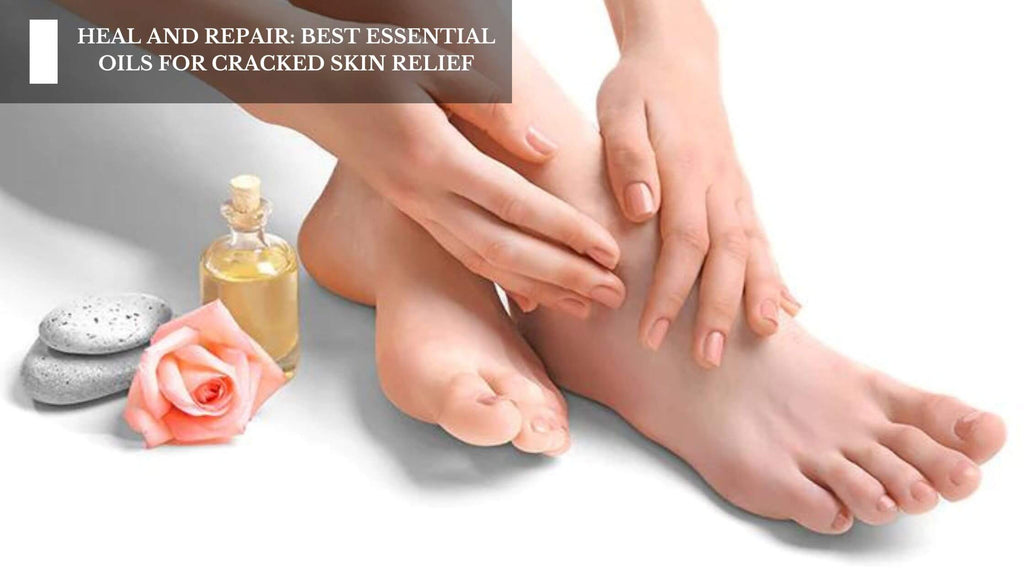 Cracked Heels care: Home remedies to cure cracked heels - Times of India |  - Times of India