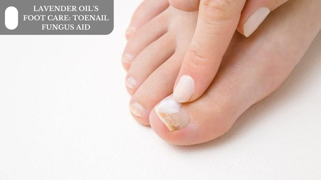 Healthpoint Fungal Nail Treatment 5ml - Bodycare Online