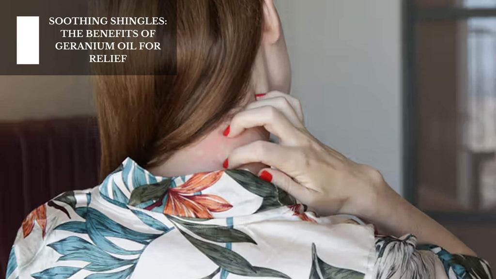 SOOTHING SHINGLES: THE BENEFITS OF GERANIUM OIL FOR RELIEF SOOTHING SHINGLES: THE BENEFITS OF GERANIUM OIL FOR RELIEF