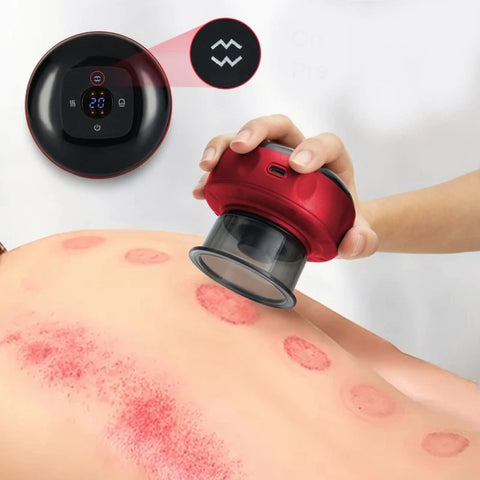 Aparelho de Massagem Relaxante com Ventosa - Cupping Pro