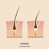catagen hair growth phase