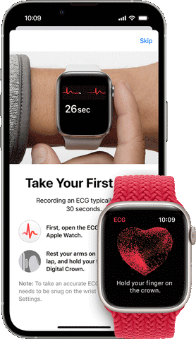 iPhone displaying Apple Watch heart scanner and ECG app. Beside it is an Apple Watch displaying the ECG screen and information