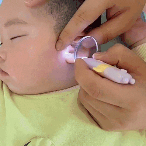 Limpador de ouvido de bebê elétrico - Clear Baby