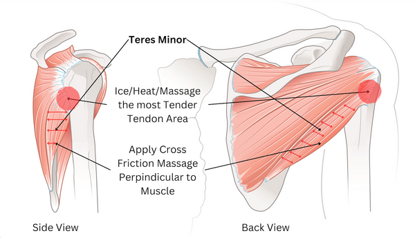 Teres Minor Care