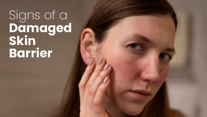 Signs of a Damaged Skin Barrier