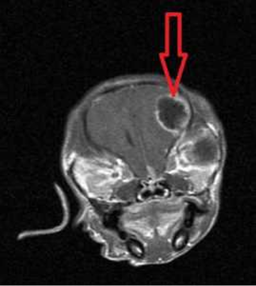 CT scan of canine skull with tumor on brain causing seizures