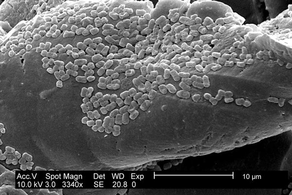 Black and white scanning electron microscopic image of Escherichia coli (E. coli) biofilm