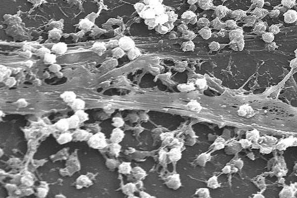 Black and white scanning electron microscopic image of Staphylococcus aureus biofilm