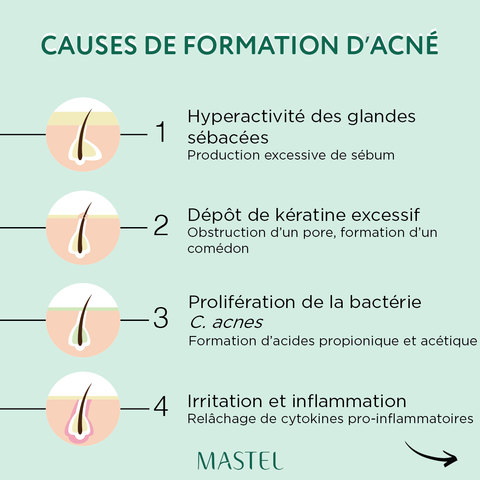 Causes de l'acné pour solution