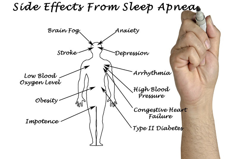 Sleep apnea