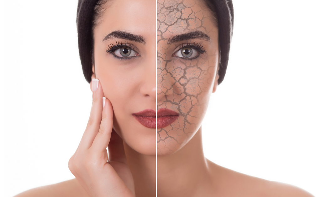 how to repair skin's barrier, damaged skin barrier