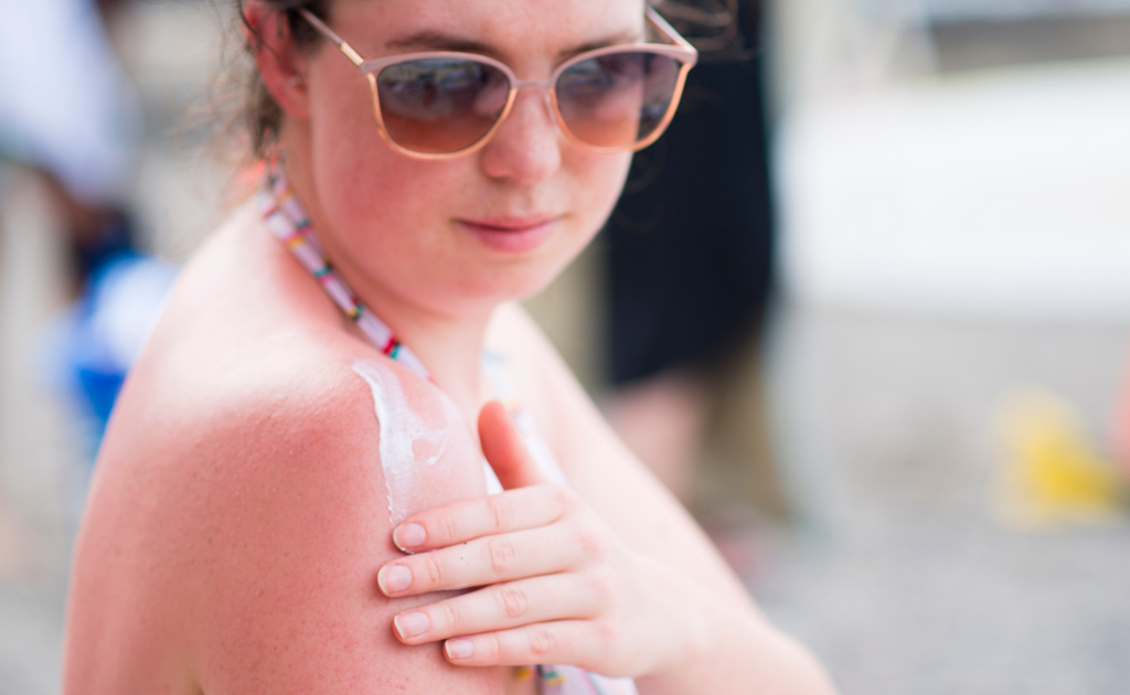 Recognizing the Signs of Sun Damage