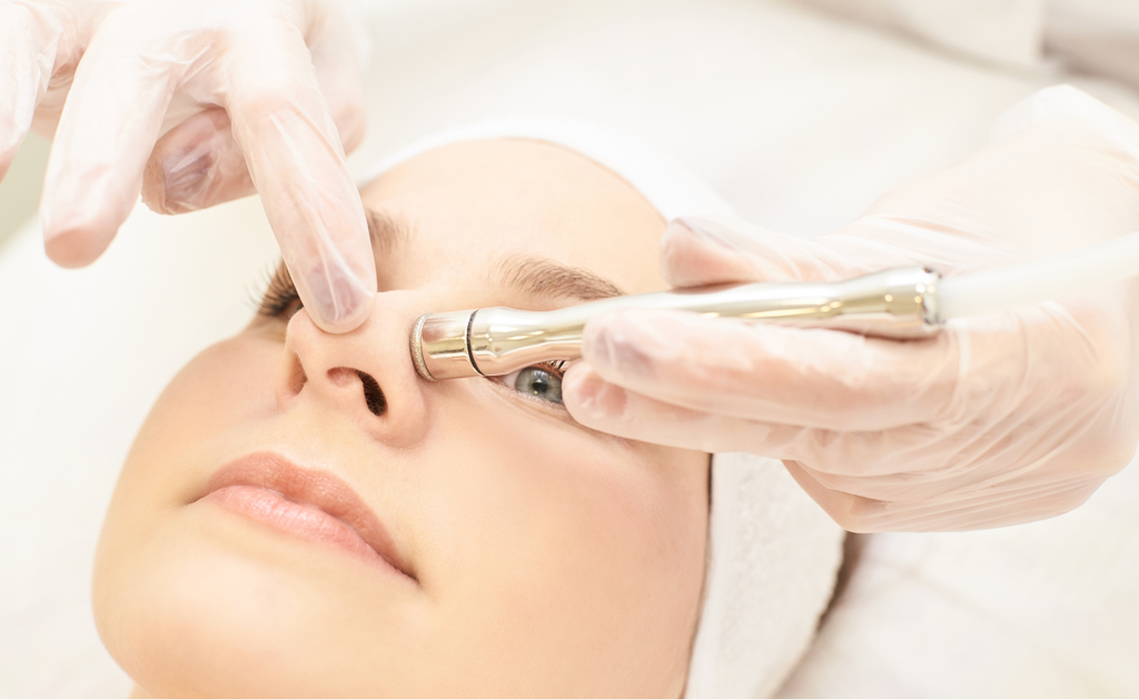 Laser treatment for acne scars