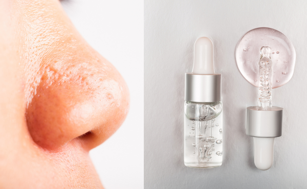 Serums with hyaluronic acid, vitamin c and products without pore clogging ingredients lead to clear skin. 