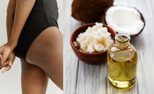 Coconut oil  reduce the appearance of stretch marks